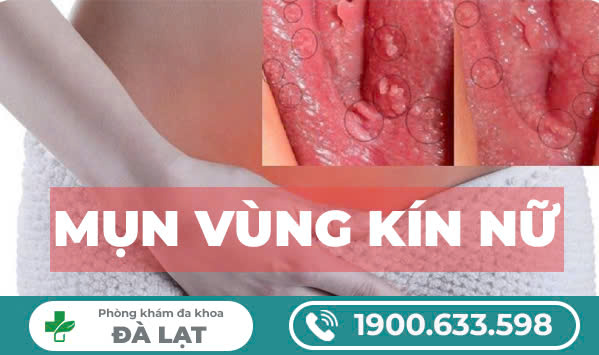 Hình ảnh minh họa